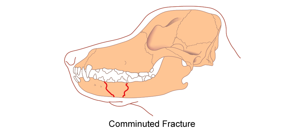 mandible comminuted